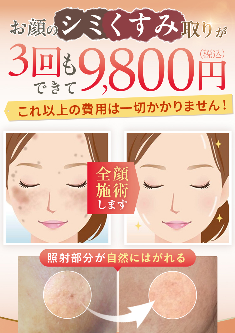 新発想 シミにスポットアプローチ 徹底シミ&美白ケア