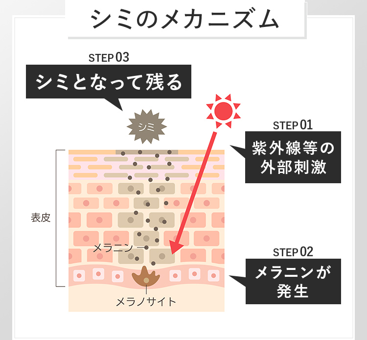 シミのメカニズム