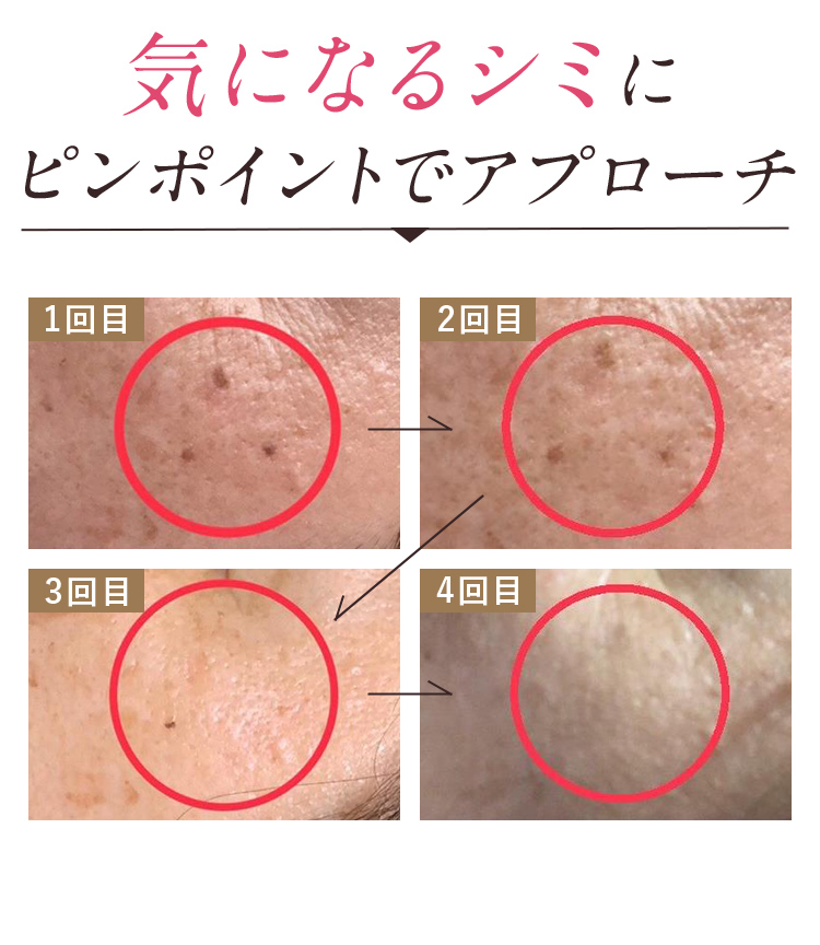 気になるシミにピンポイントでアプローチ
