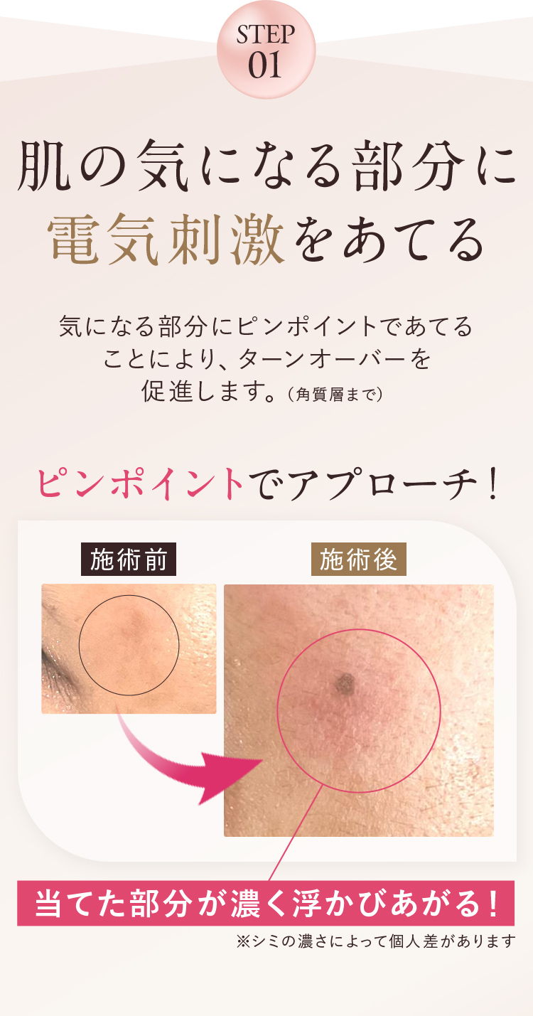 STEP1 肌の気になる部分に電気刺激を当てる