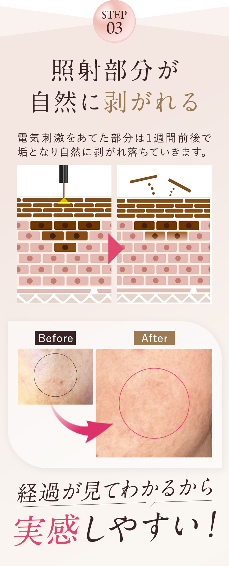 STEP3 照射部分が自然に剥がれる