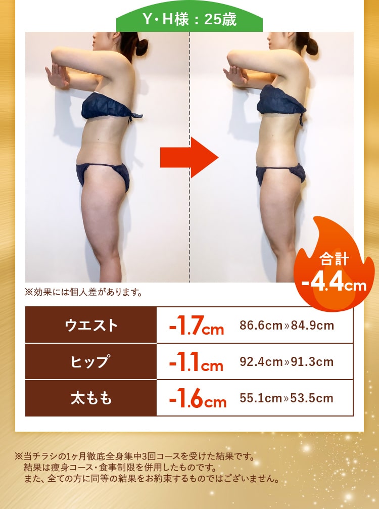 Y・H様 : 25歳   合計-4.4cm※効果には個人差があります。