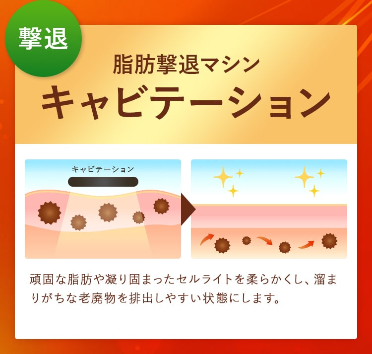 撃退!脂肪撃退マシン! キャビテーション 